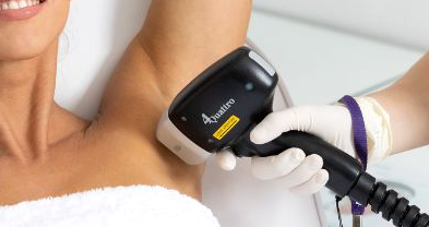 Underarm Laser Hair Reduction